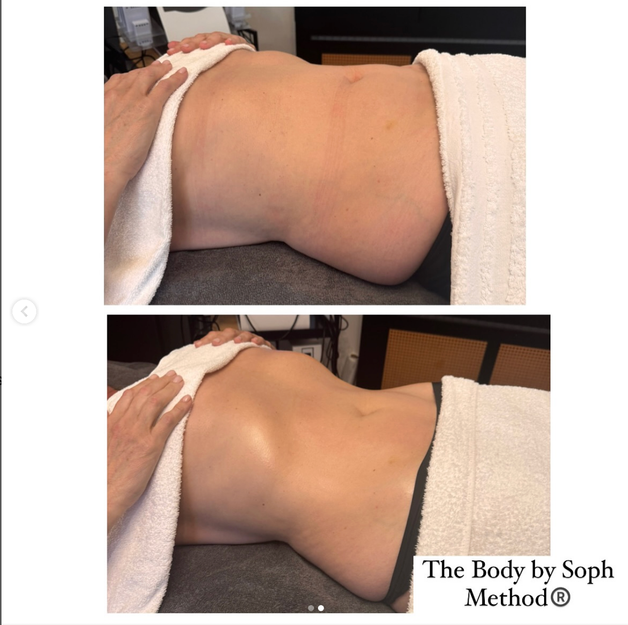 Zoe Ball’s body transformation after a lymphatic drainage massage