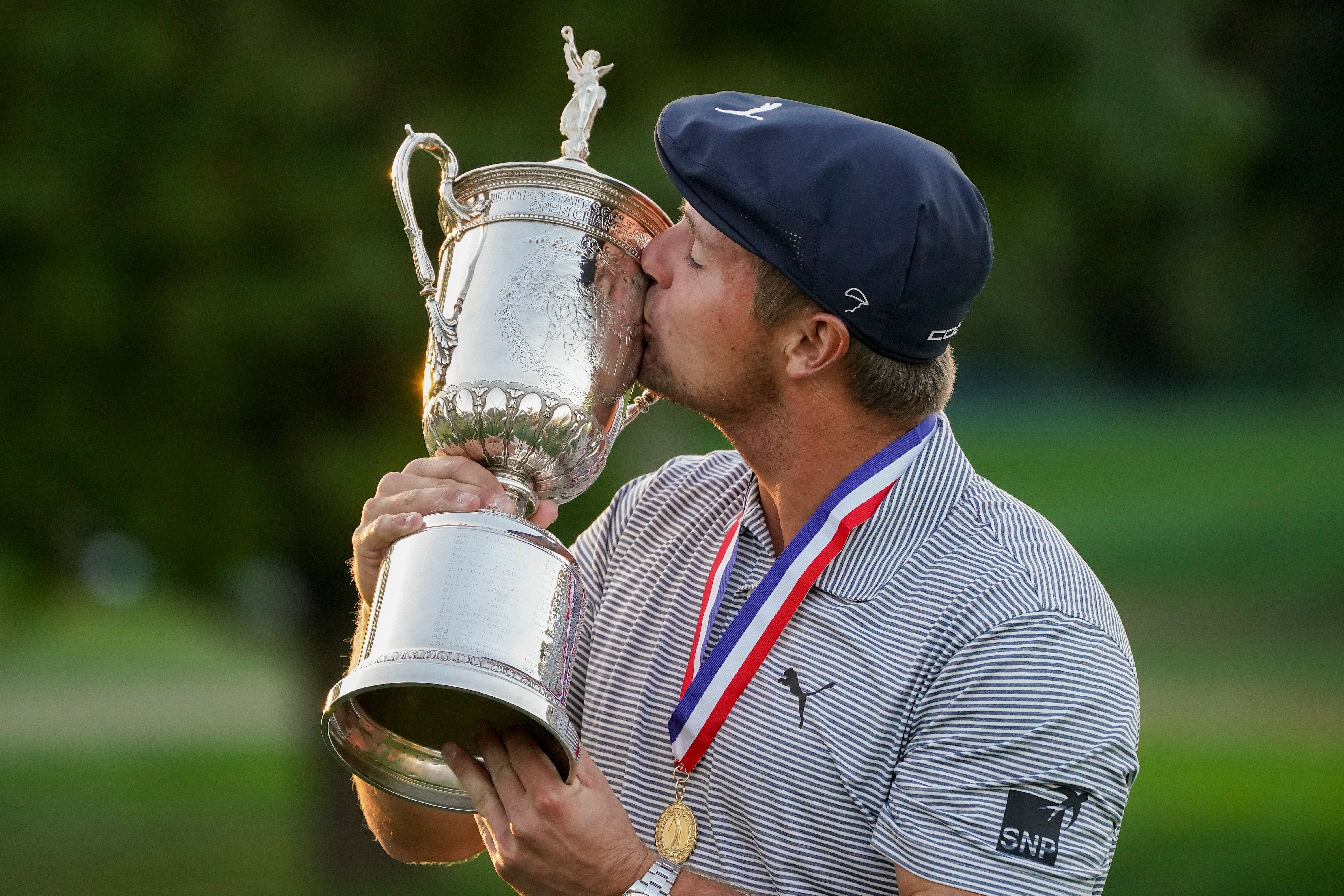 APTOPIX US Open Golf