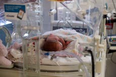 NHS maternity units continuing to ‘conceal’ and ‘disguise’ failings