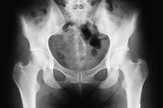 Patients shocked after surgeon is accused of ‘hoarding body parts’