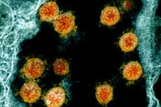 Mild to severe: Immune system holds clues to virus reaction
