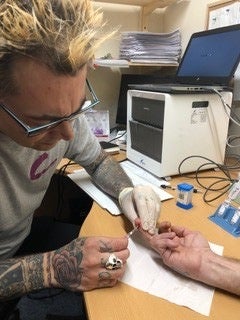 Bonnet conducts a hepatitis C finger-prick test on a patient at his mobile laboratory