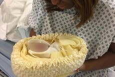 ‘Like Chrissy Teigen I took photographs of both the babies I lost’