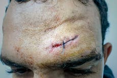 Croatia accused of brutality, sexual abuse against migrants