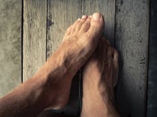 Covid toes: The possible coronavirus symptom that can cause chilblain-like inflammation