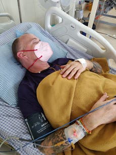 British man blinded and paralysed after snakebite while battling suspected Covid in India