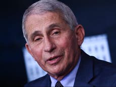 Fauci gets lifetime achievement award for HIV/AIDS work