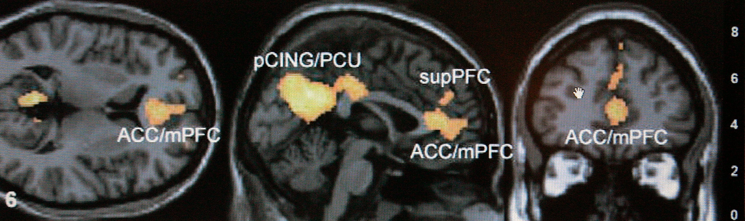 Brain Scans Challenged