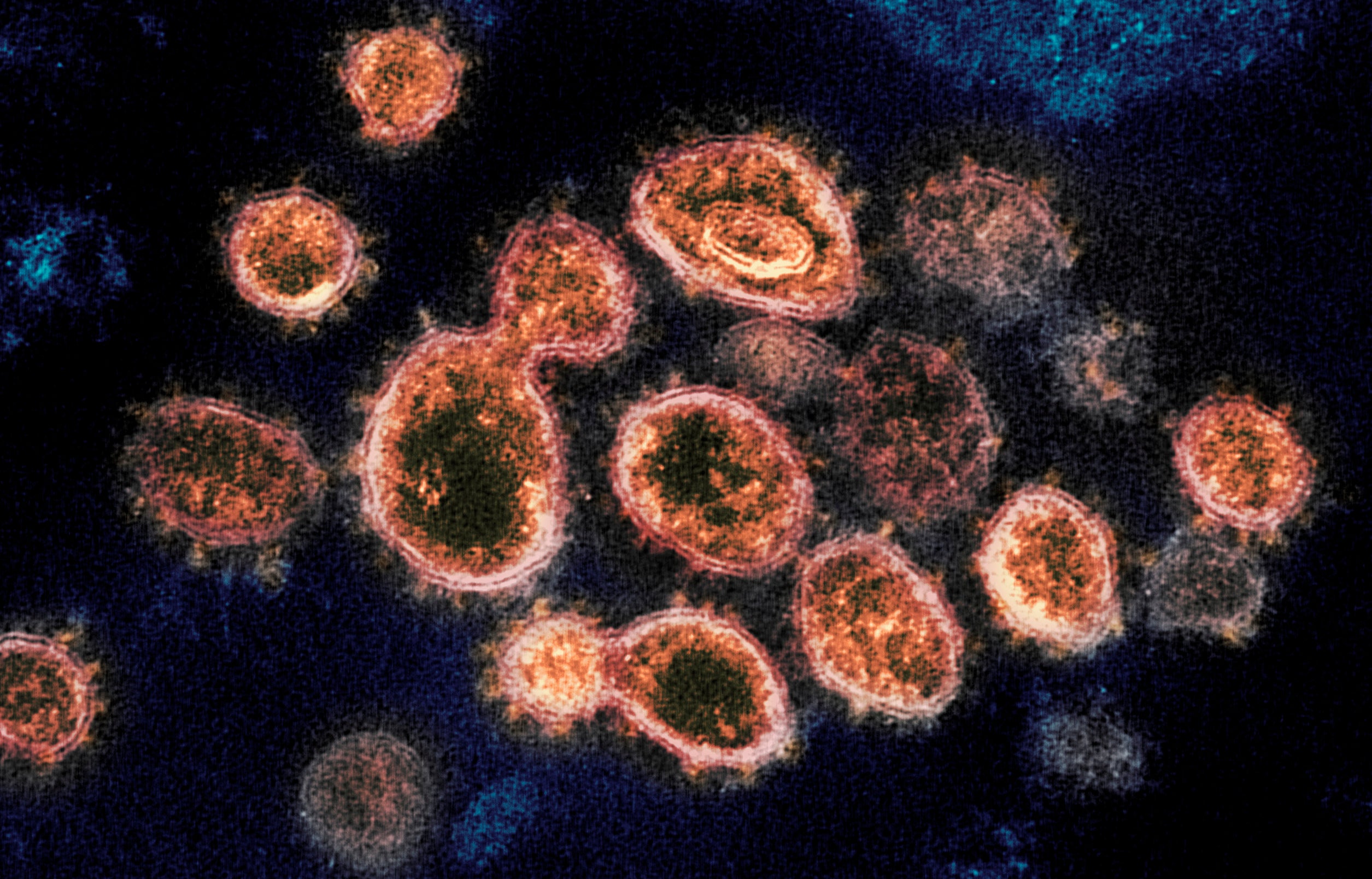 Virus Outbreak Antibody Protection