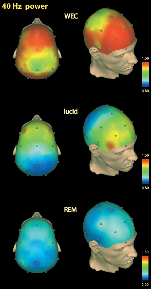 EEG differences in brain activity in the WEC (awake with eyes closed) state and REM sleep, compared with brain activity during lucid dreaming