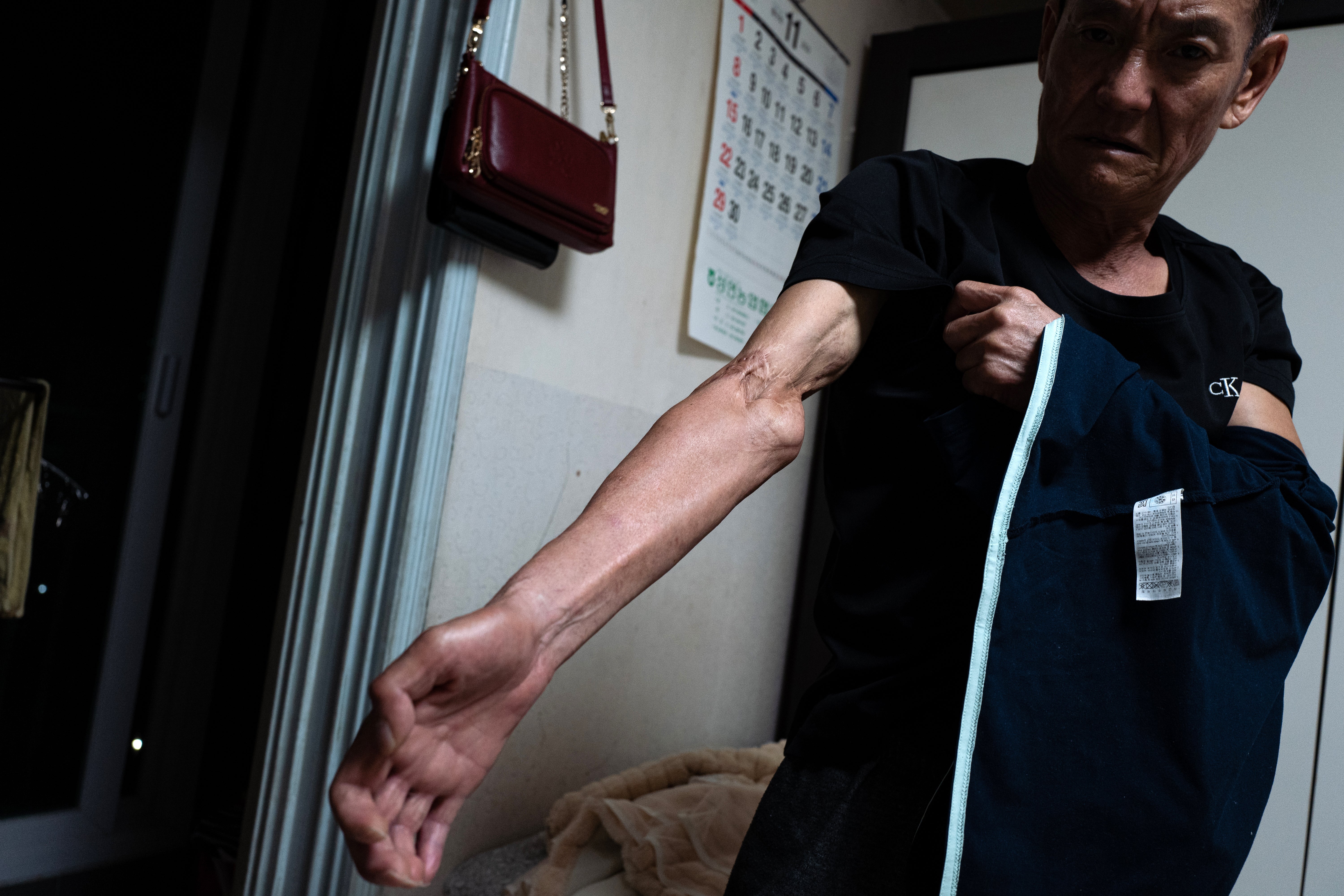 Han Hong-geun shows his injured right arm at home