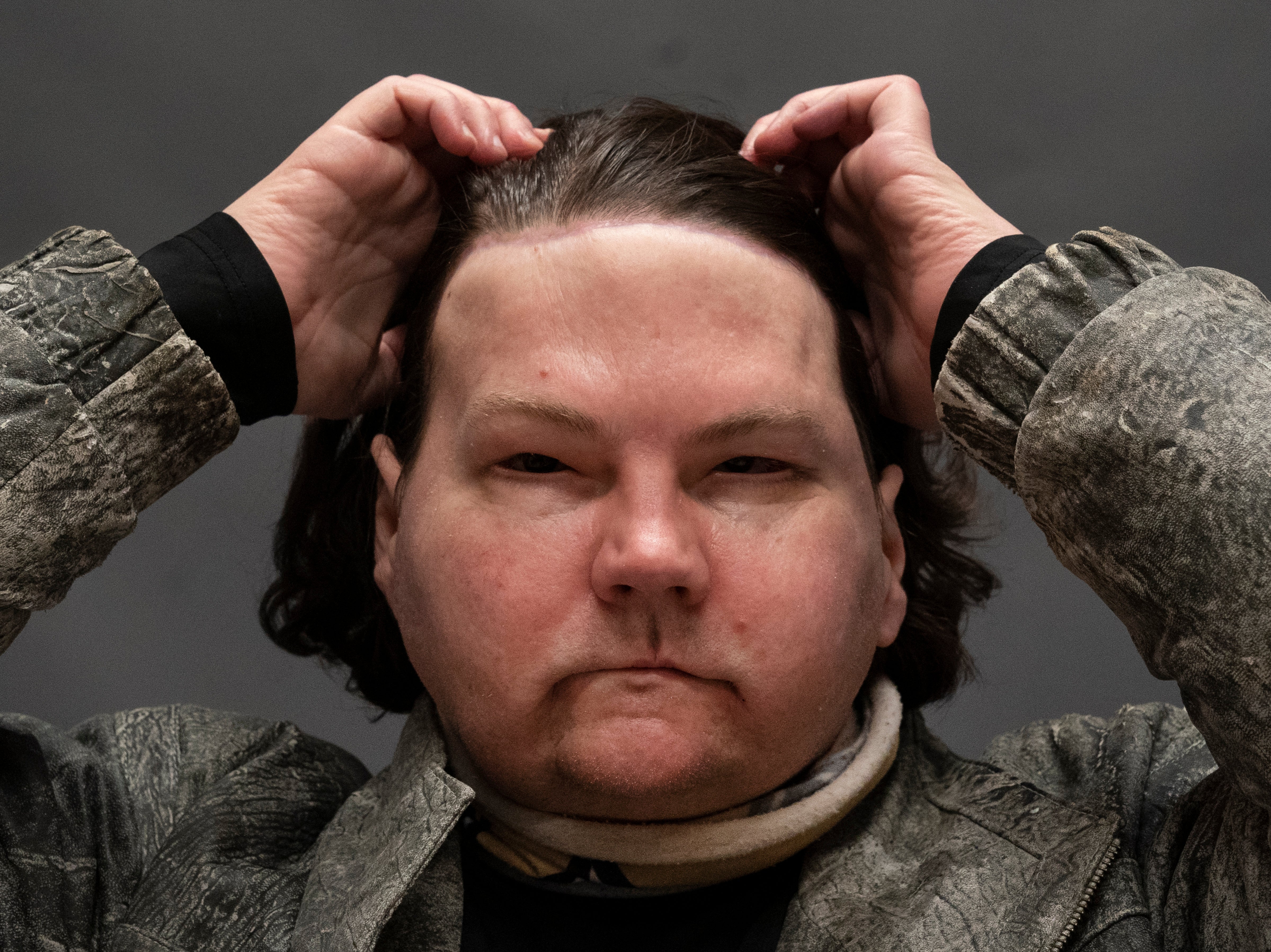 Joe DiMeo brushes back his hair while posing for a portrait, Monday, 25 January, 2021 at NYU Langone Health in New York