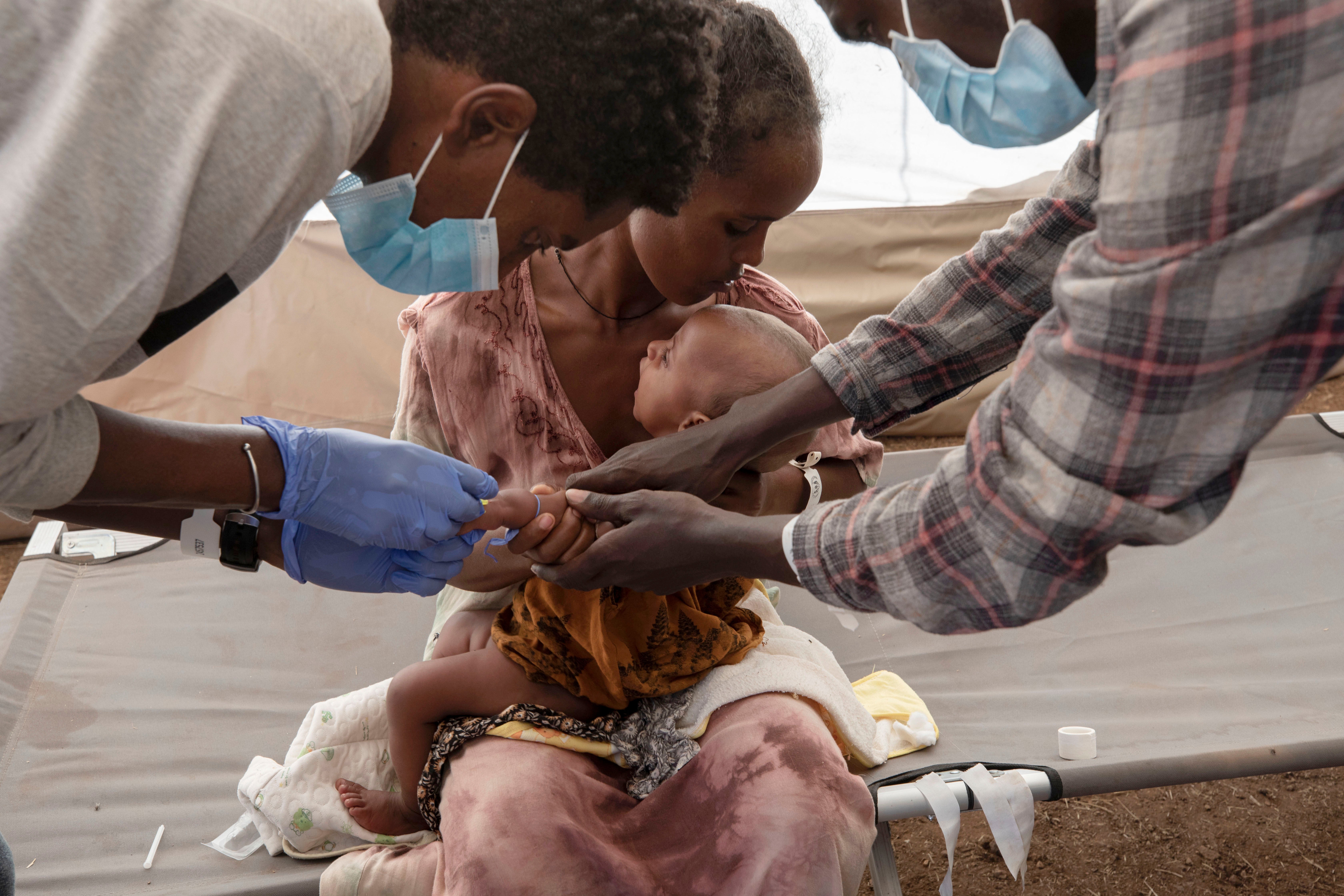 A woman who fled the conflict in Tigray, Ethiopia, holds her malnourished baby in a refugee camp in eastern Sudan on 5 December, 2020.