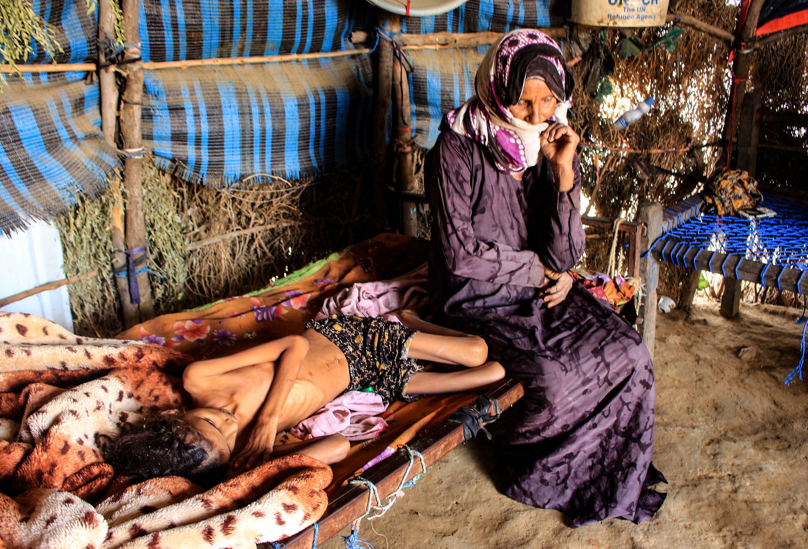 A Yemeni woman sits by the bedside of a 10-year-old girl with acute malnutrition at a camp for the internally displaced in the northern Hajjah Governorate, on 23 January