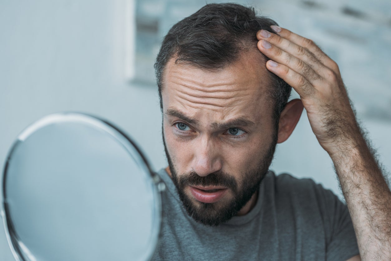 A patient with alopecia
