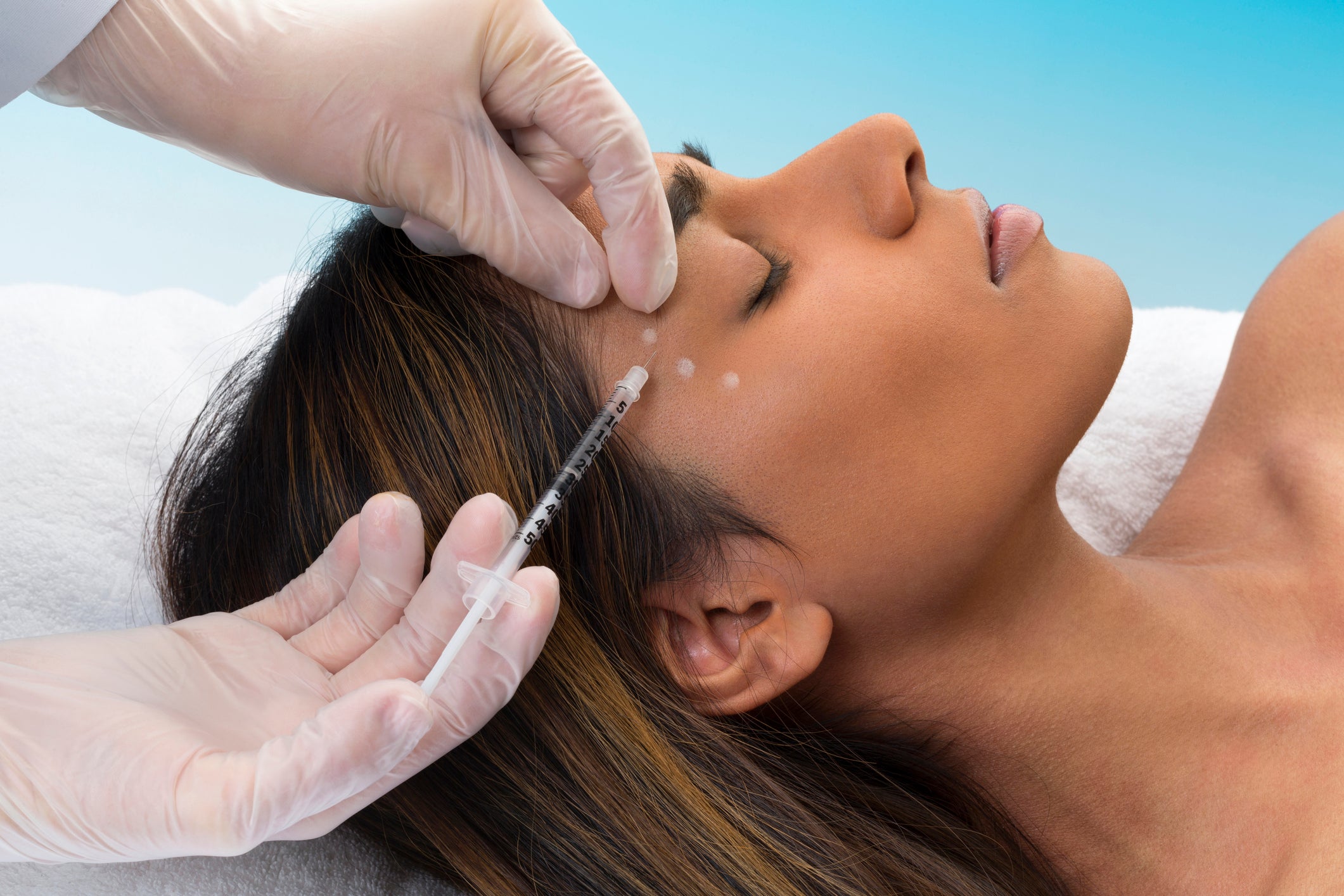 The popularity of baby Botox is part of a wider trend which has seen the procedure become destigmatised