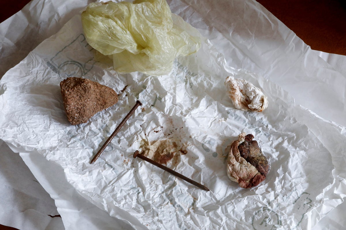 Items doctors retrieved from the vagina of a rape survivor at a hospital in Adigrat, Tigray