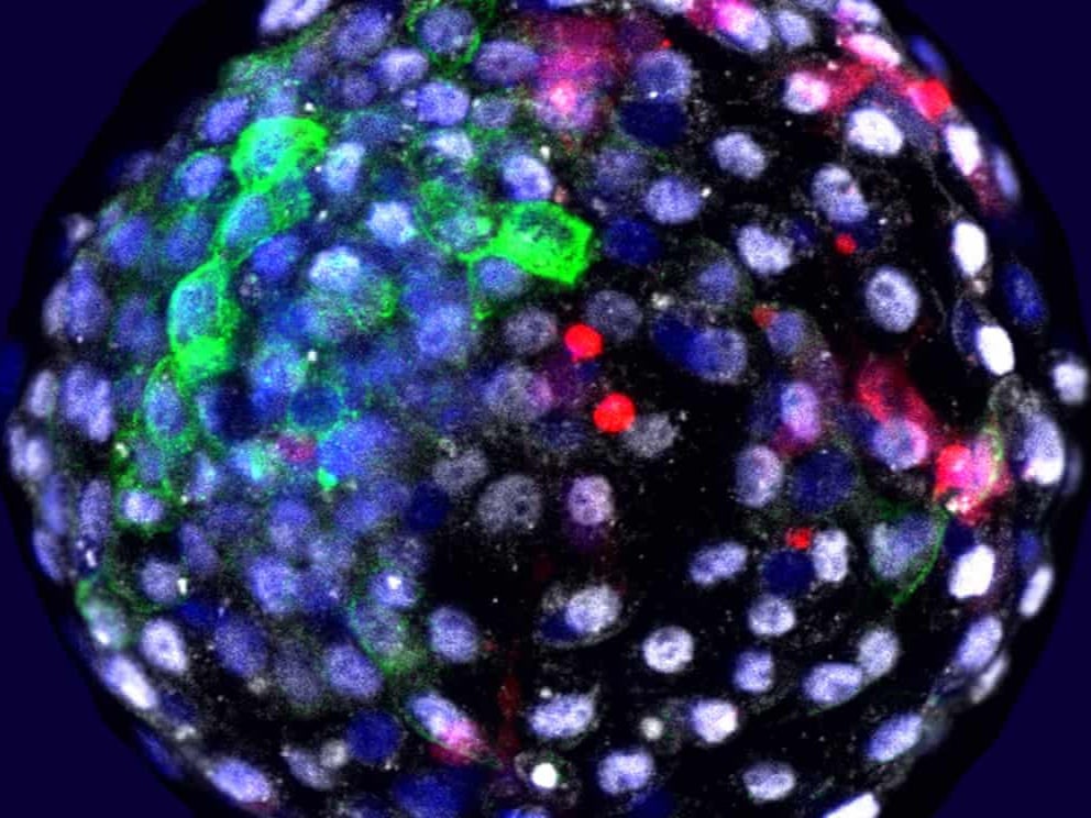 An image from the Salk Institute shows human cells grown in an early stage monkey embryo