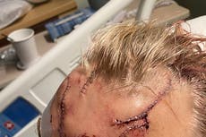 10 seconds of terror: Alaska man survives brown bear mauling