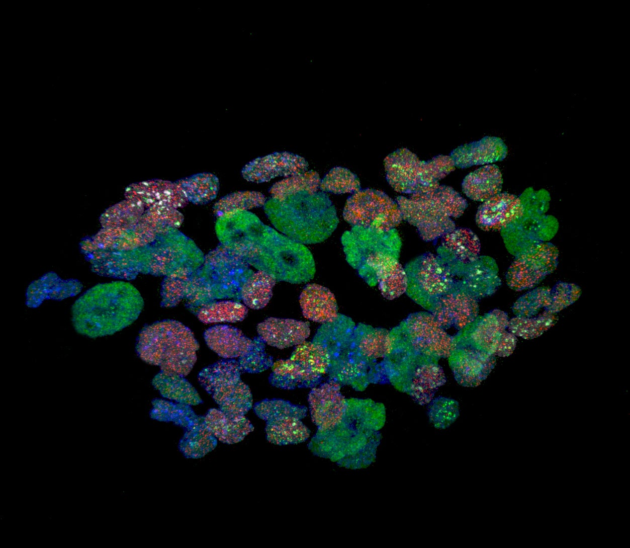 Image of a colony of mouse stem cells possessing a mutation: red and green fluorescence identifies two proteins important for DNA methylation