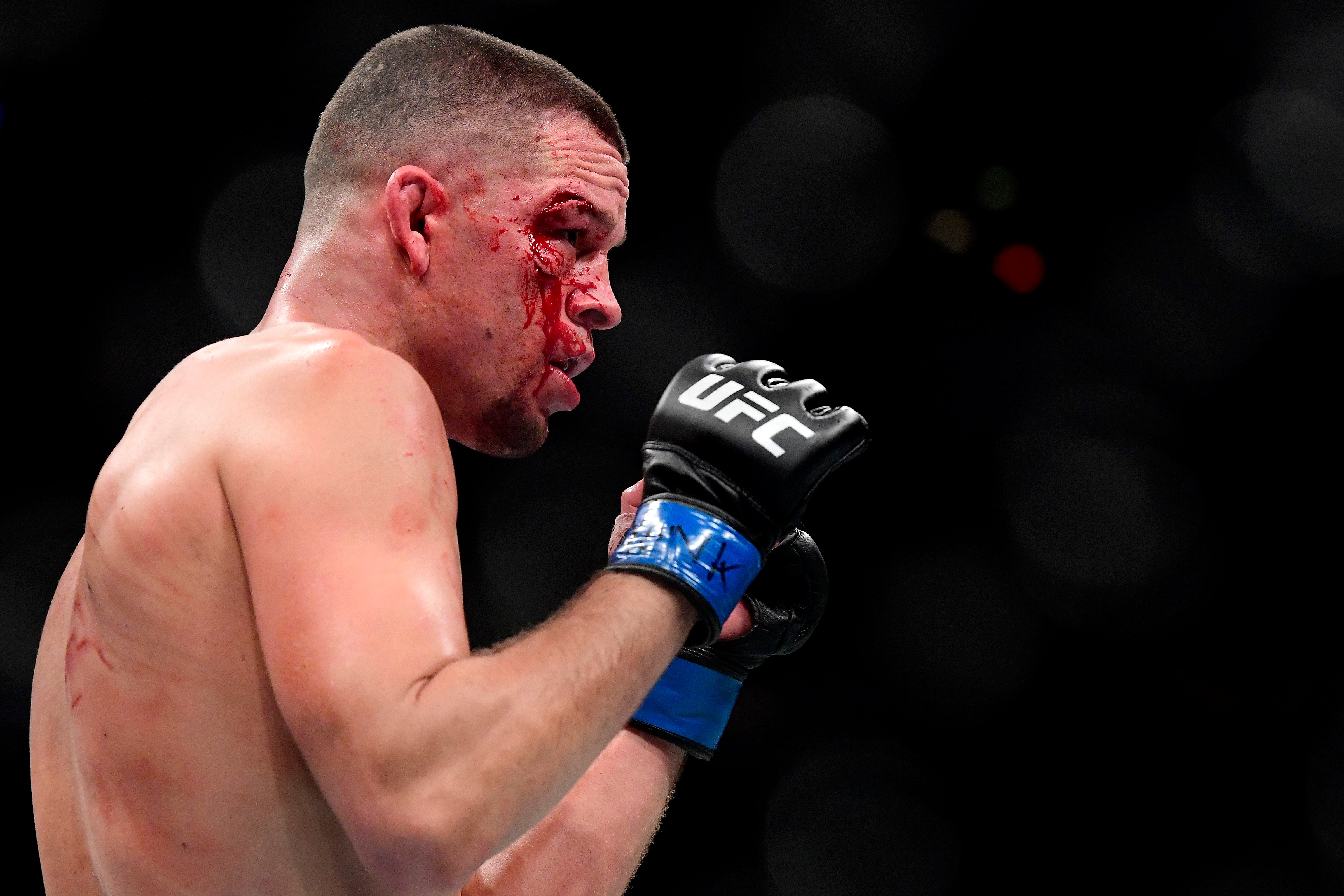 Nate Diaz last fought in November 2019, losing to Jorge Masvidal via doctor stoppage