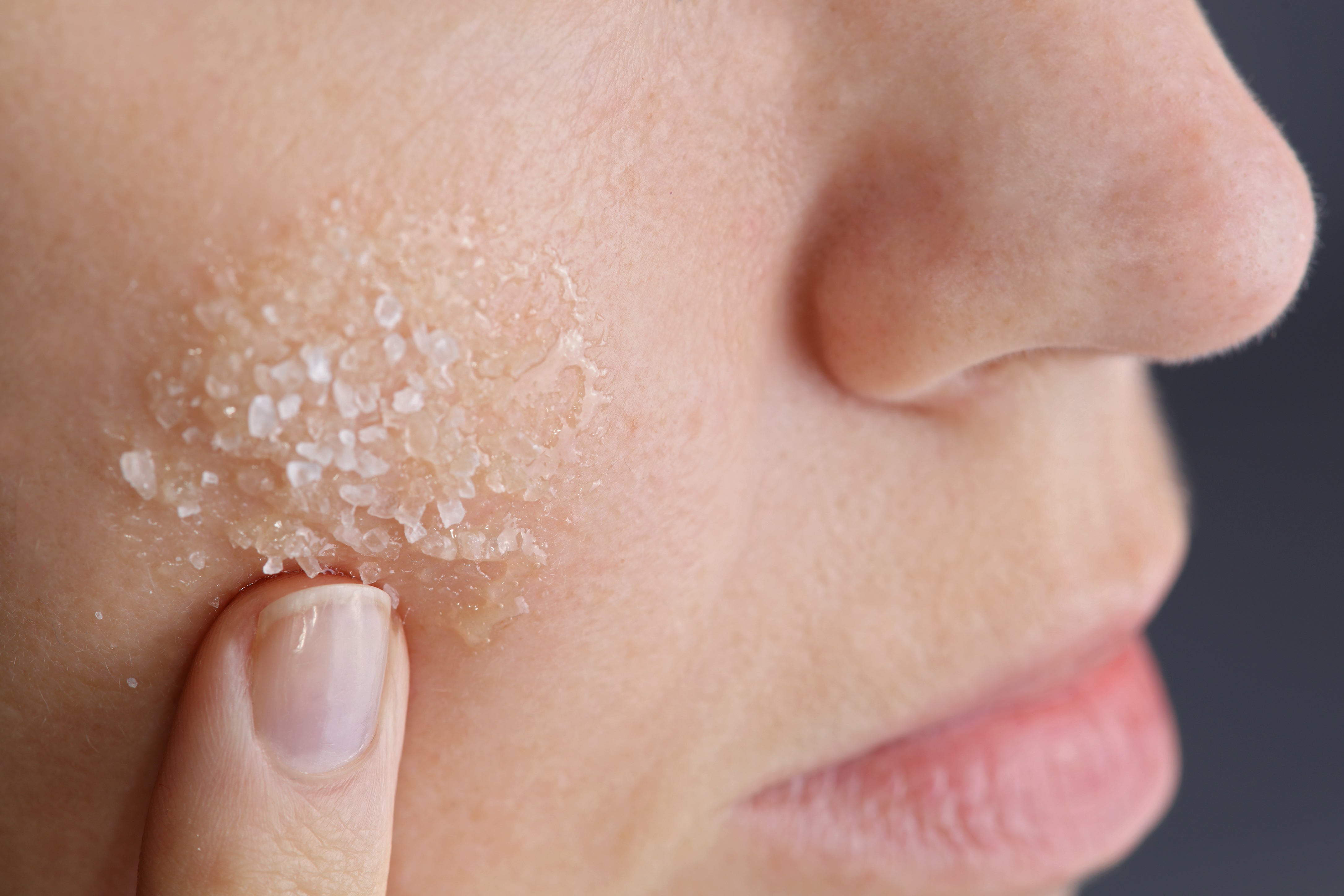 Natural, at-home remedies are not always the best thing for your skin