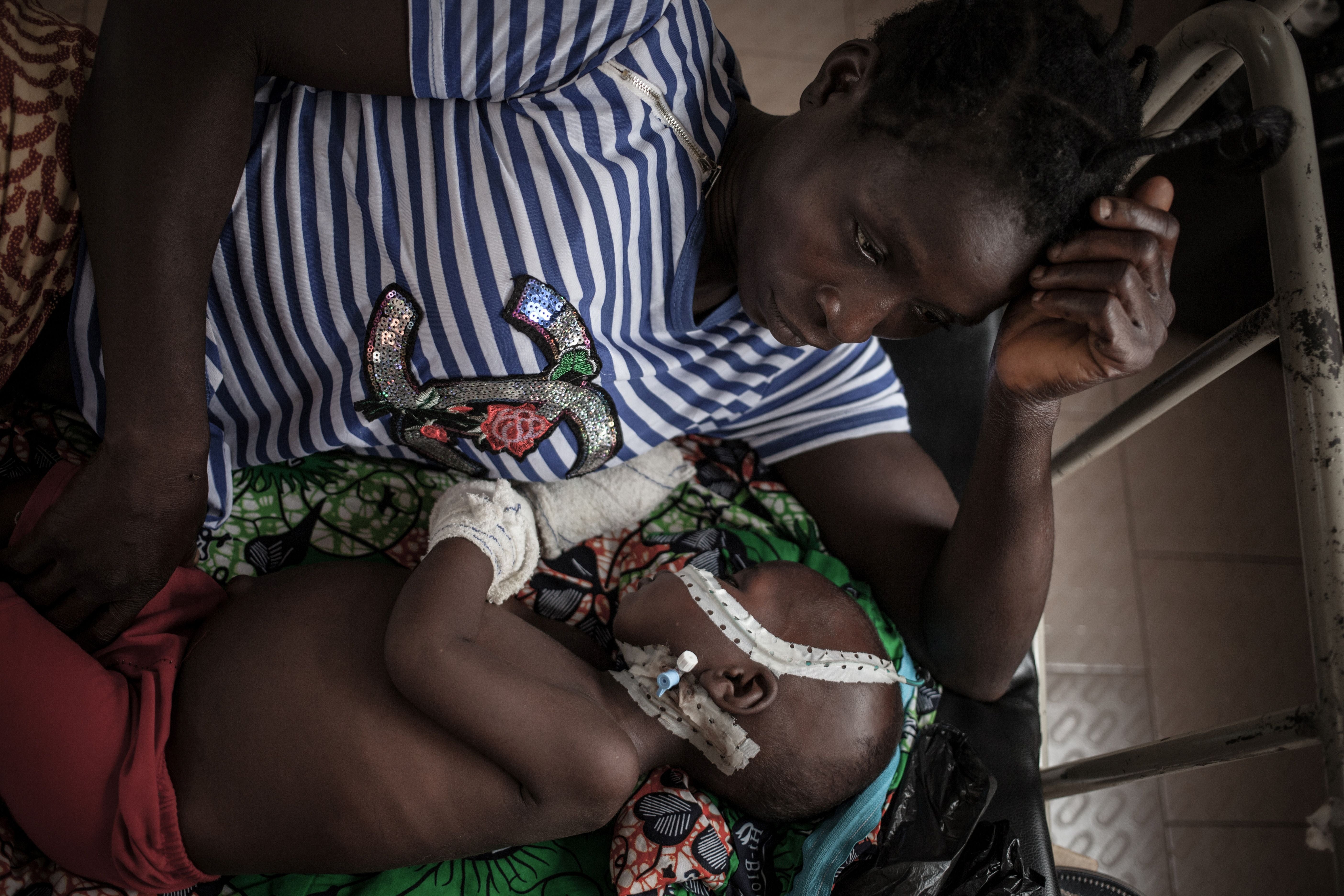 A mother watches over her child, who was born HIV-positive, at a paediatric centre in the Central African Republic in 2018