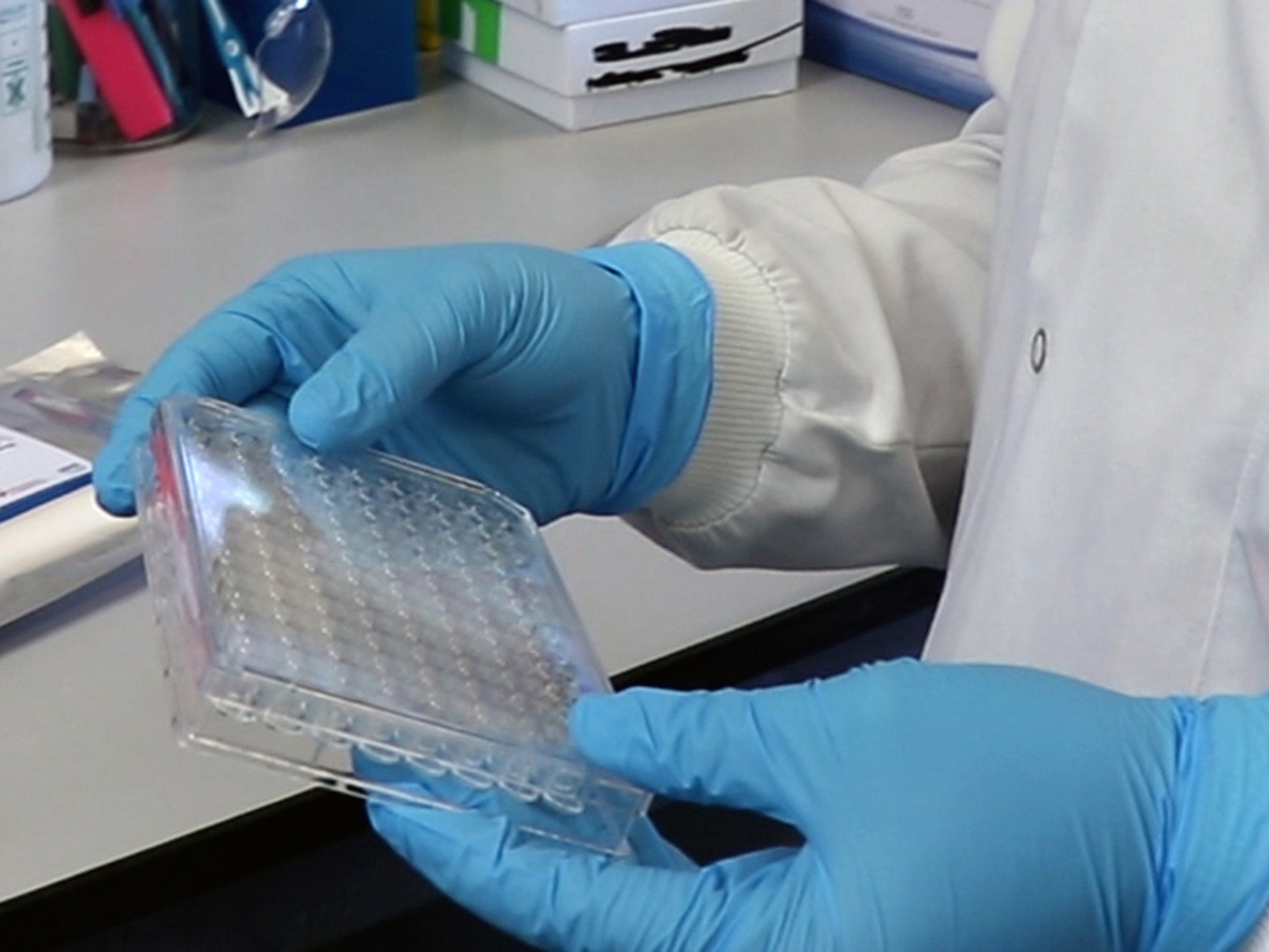 Immune response six months after suffering coronavirus can vary between individuals