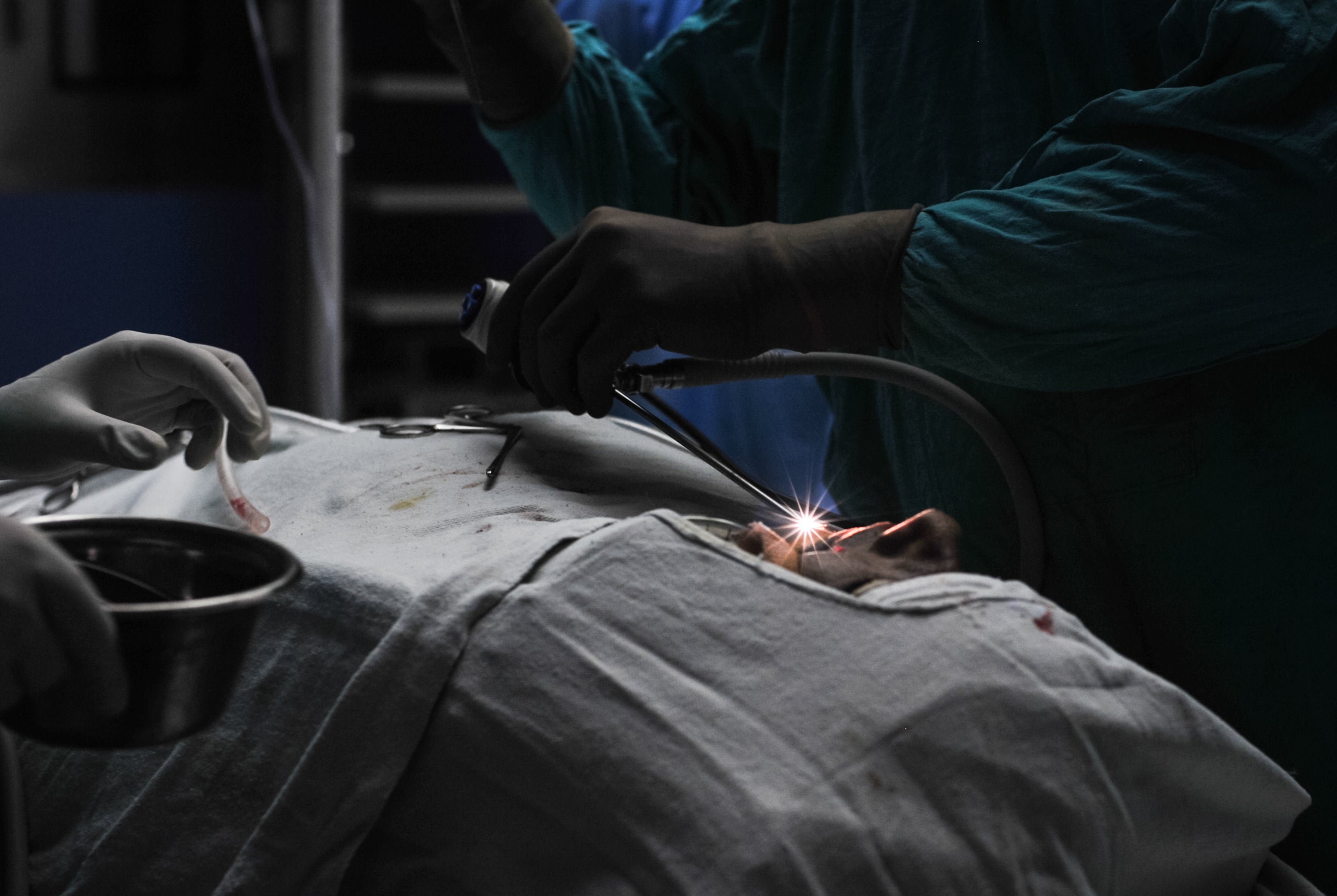 A doctor performs surgery to remove mucormycosis from a patient at Swaroop Rani hospital