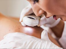 Major breakthrough as new treatments for most severe form of skin cancer could be developed