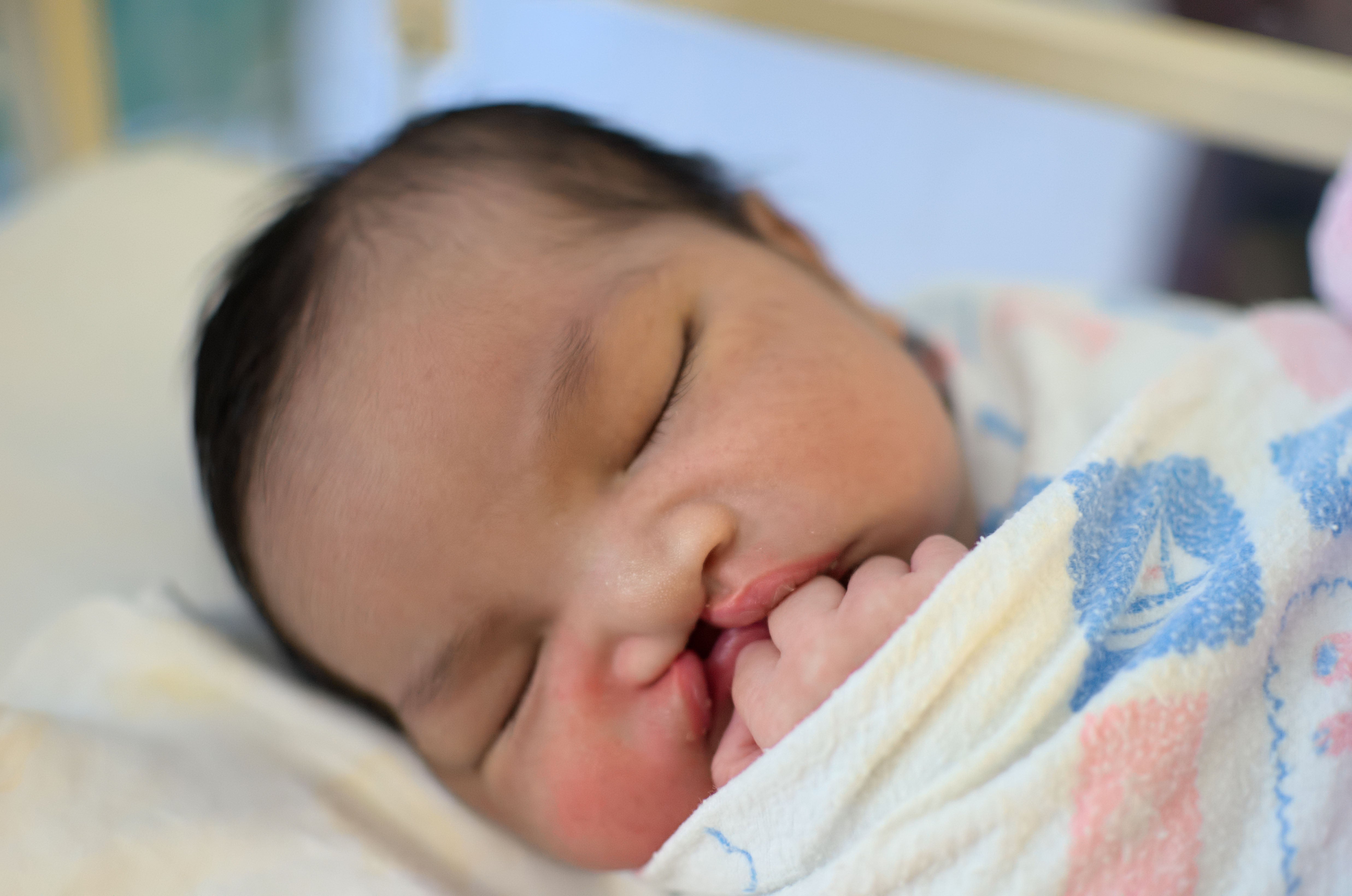 Newborn baby with cleft lip and palate sleeping.