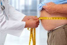 Scientists find ‘game-changing’ rare gene variants that protect against obesity after huge DNA study