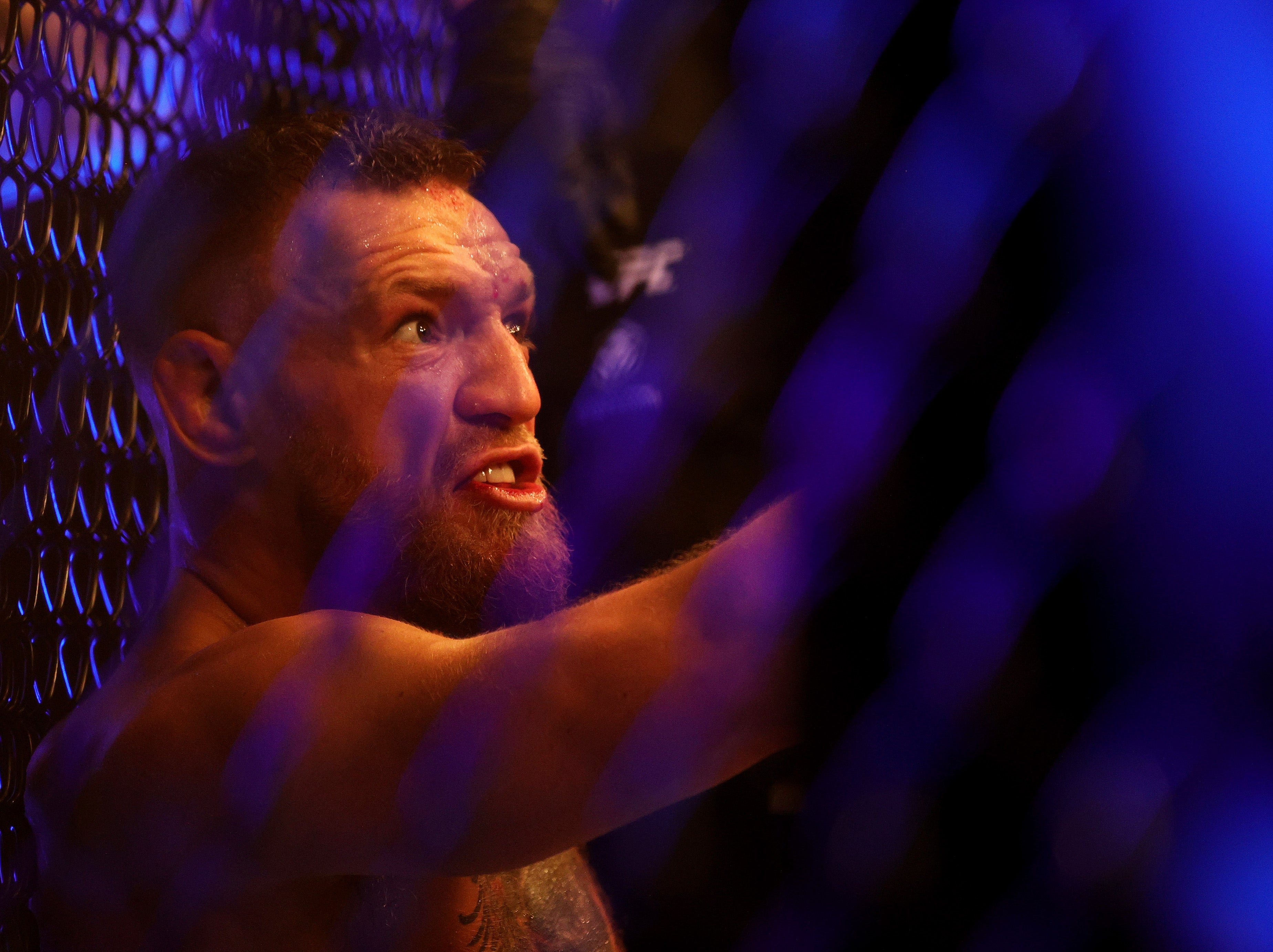 <p>Conor McGregor reacts angrily after losing via doctor stoppage</p>