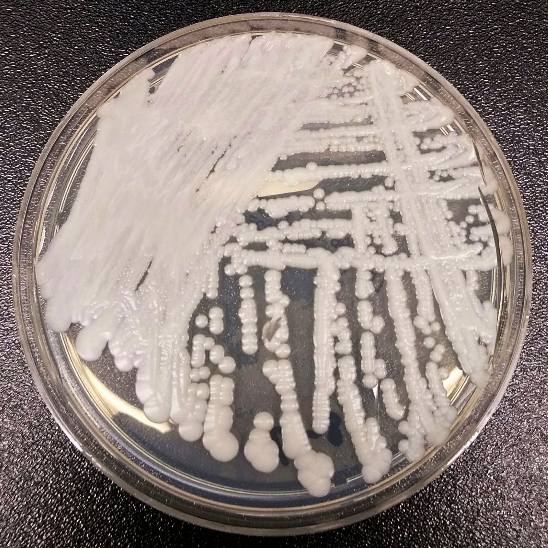 A strain of Candida auris cultured in a petri dish at a CDC laboratory