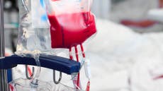 Critical call for Black people to donate blood as ‘number of sickle cell patients grows’