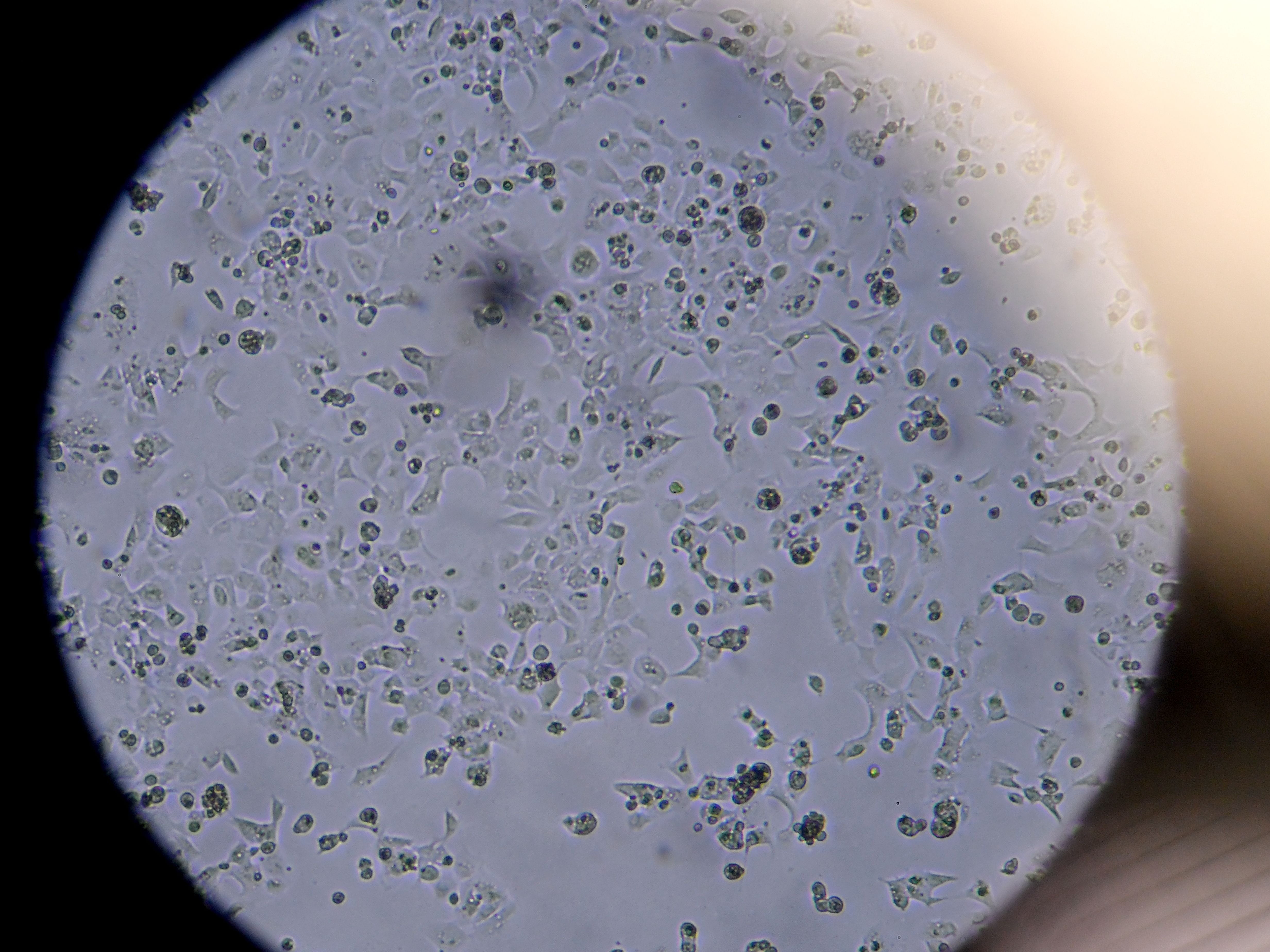 Though a glass darkly: Cells containing Sars-CoV-2 as seen in a microscope