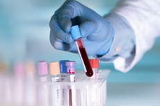 NHS to screen 140,000 people for early stages of 50 types of cancer in the blood test’s biggest ever trial