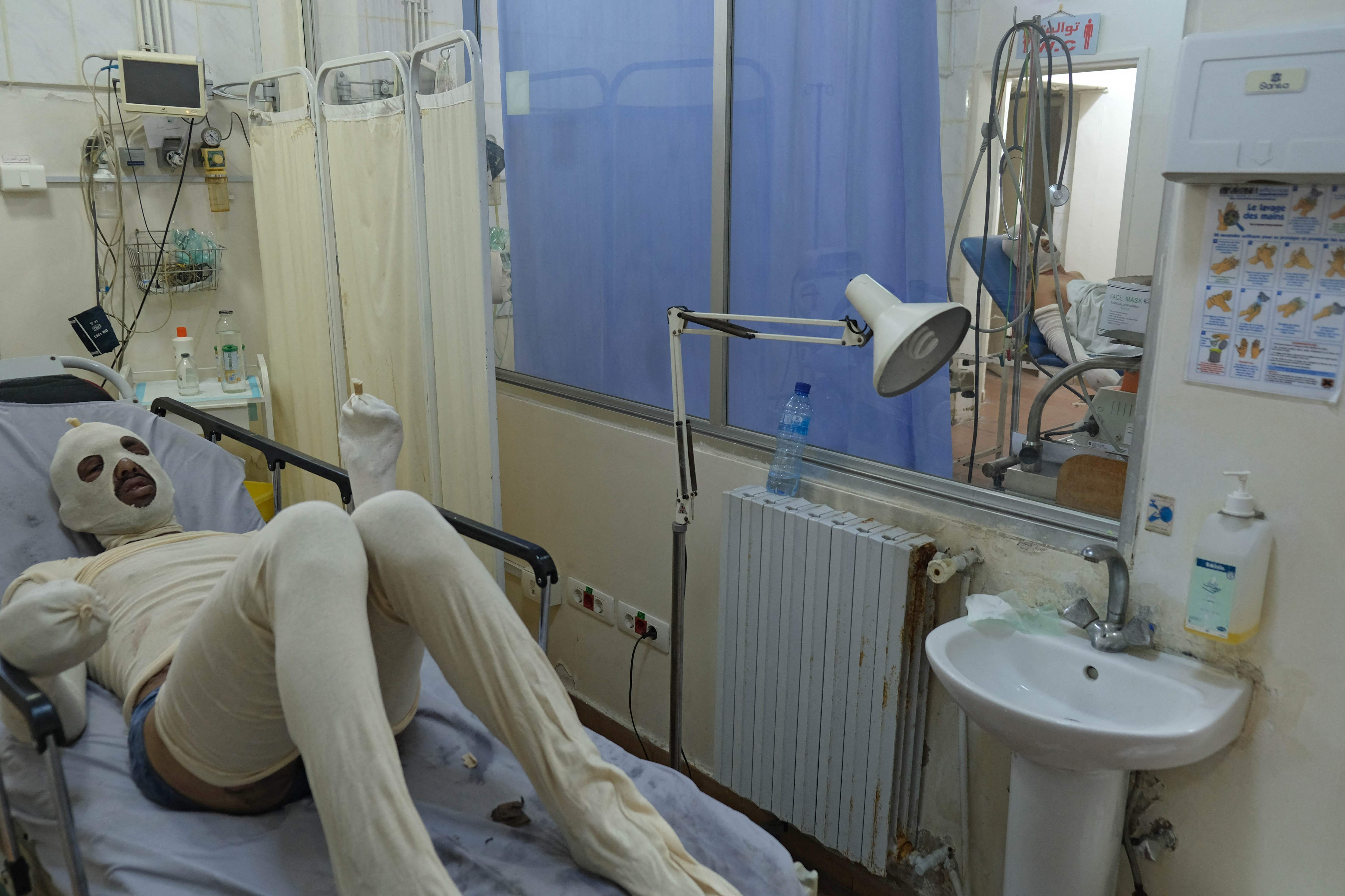 A man covered in sterile gauze to treat burns lies in bed at the Salam Hospital in the northern city of Tripoli