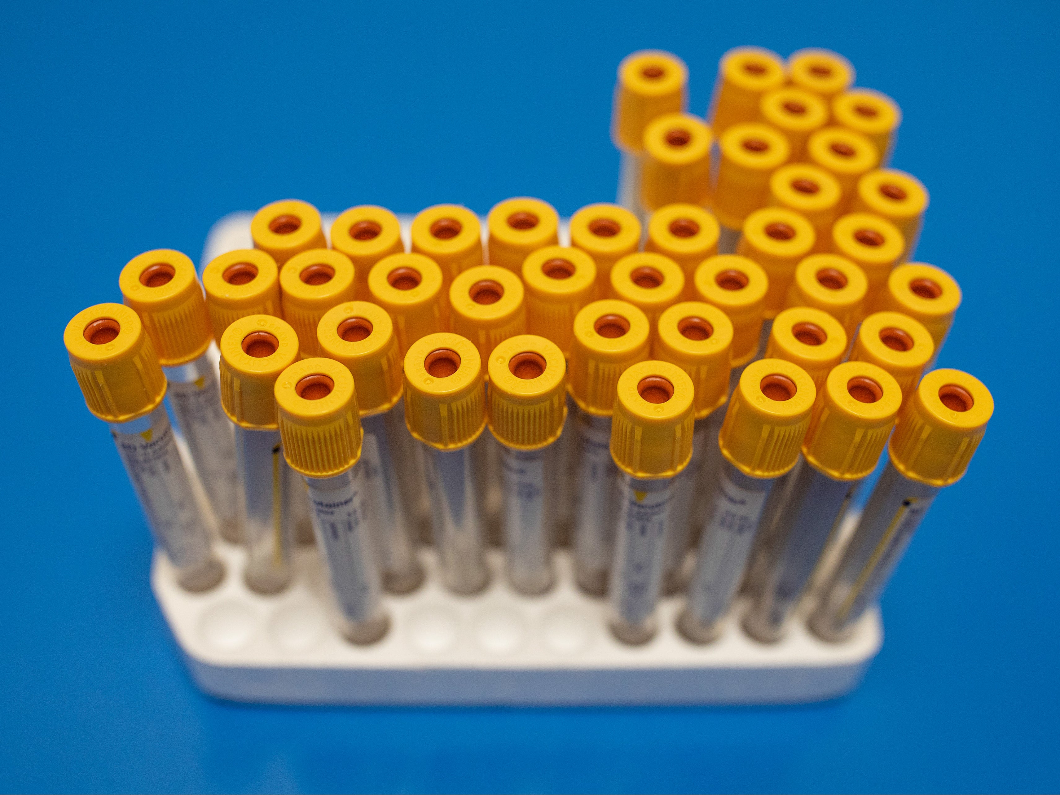 The drug combines two antibodies that bind to different places on the coronavirus spike protein