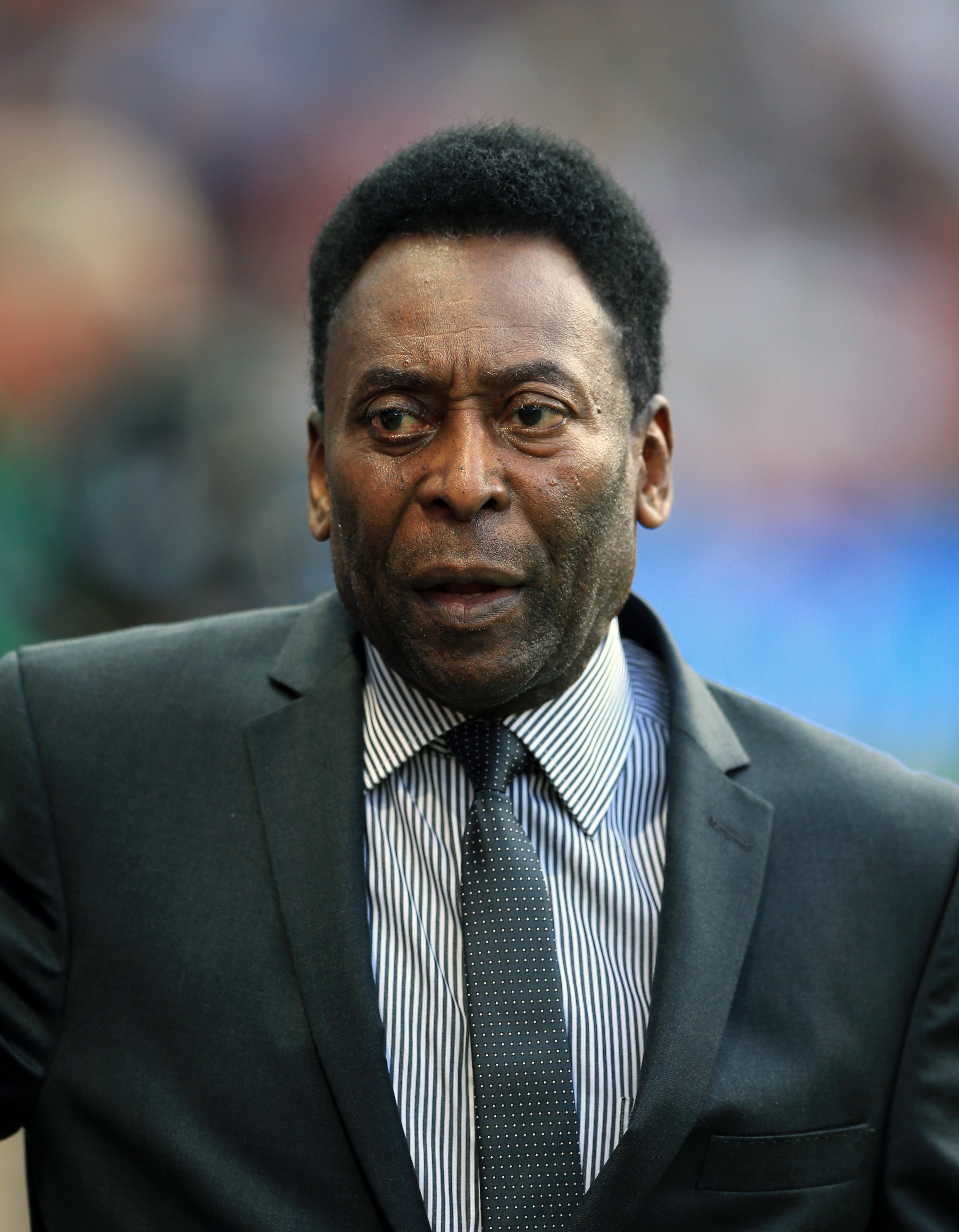 Pele has revealed recent surgery (Nigel French/PA)