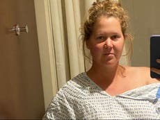 Amy Schumer wants to tell endometriosis story after uterus removal: ‘It’s going to change my life’