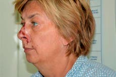 Croatian police identify woman found with memory loss