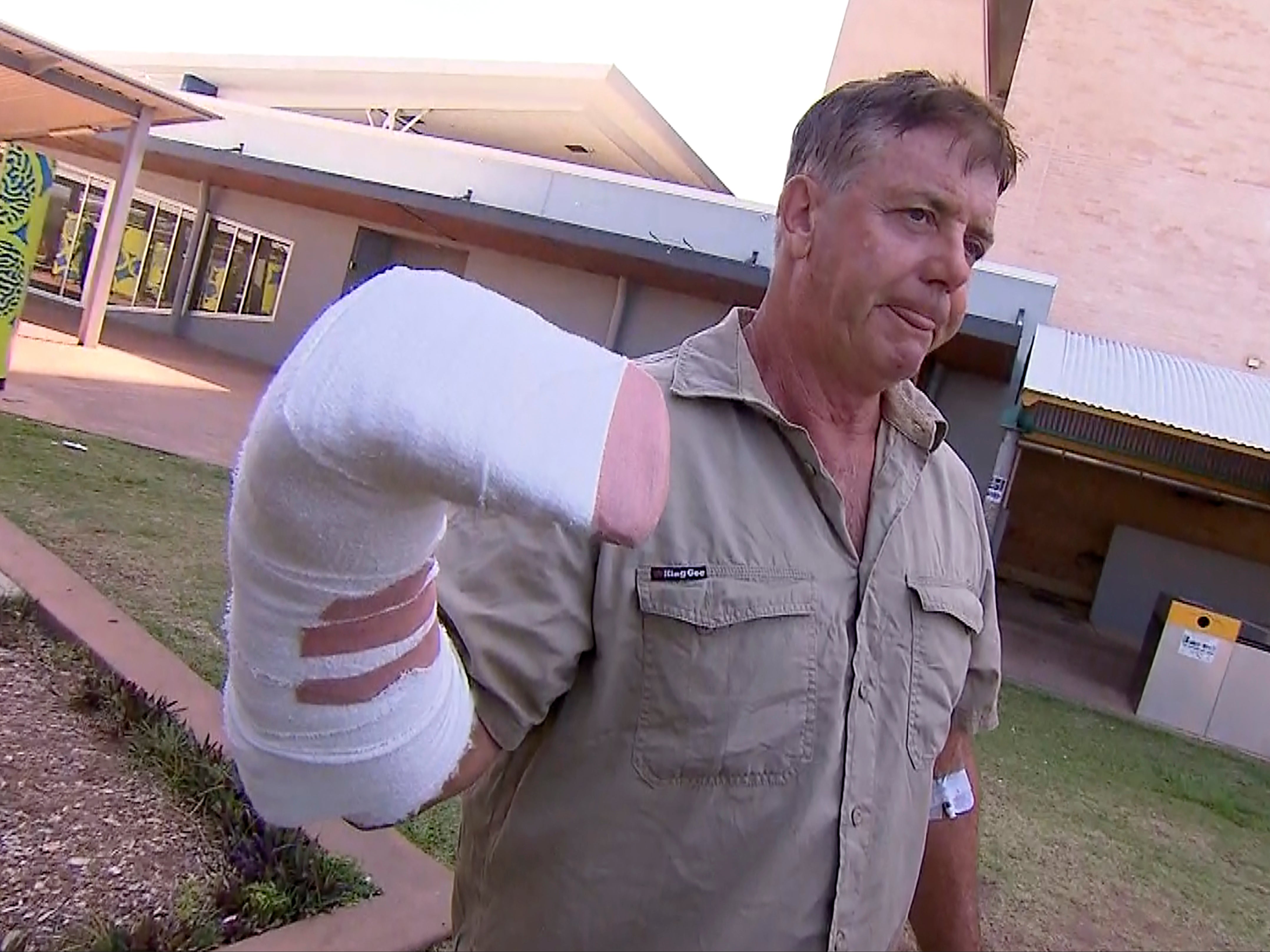 Sean Dearly underwent surgery to repair a severed tendon in his hand