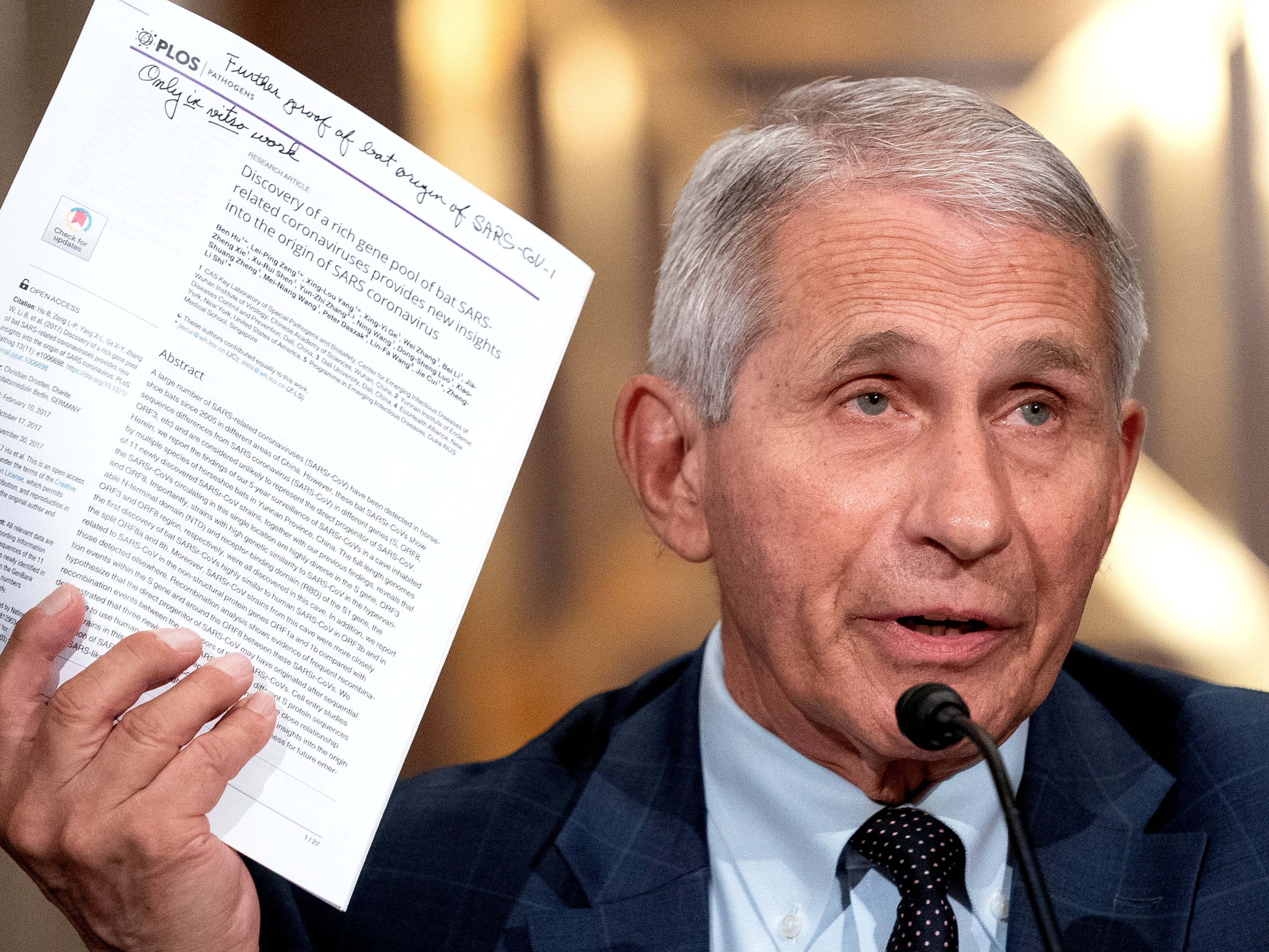 ‘The slope is going down’: Fauci gives optimistic prediction on Covid 