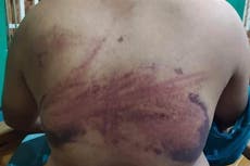 US wants probe into claims of mass torture of detainees by Myanmar’s military