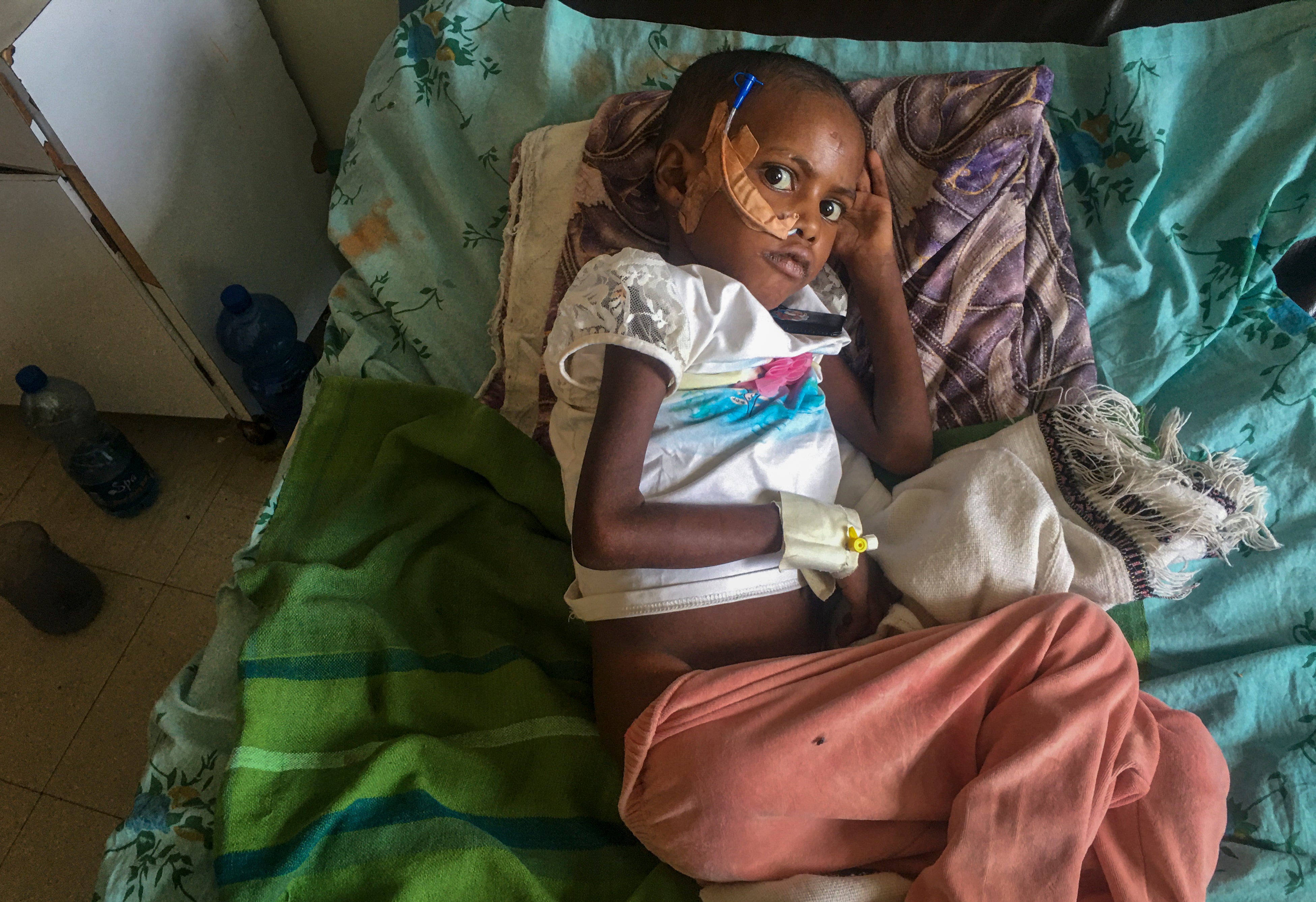 Genet Mehari, 5, is treated for malnutrition but with limited medicine, at the Ayder Referral Hospital in Mekele, in the Tigray region