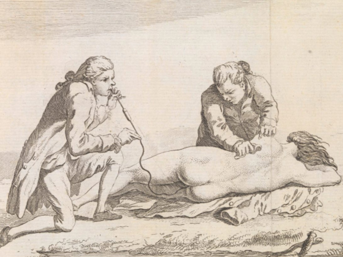 A ‘drowned’ woman being resuscitated with a smoke enema