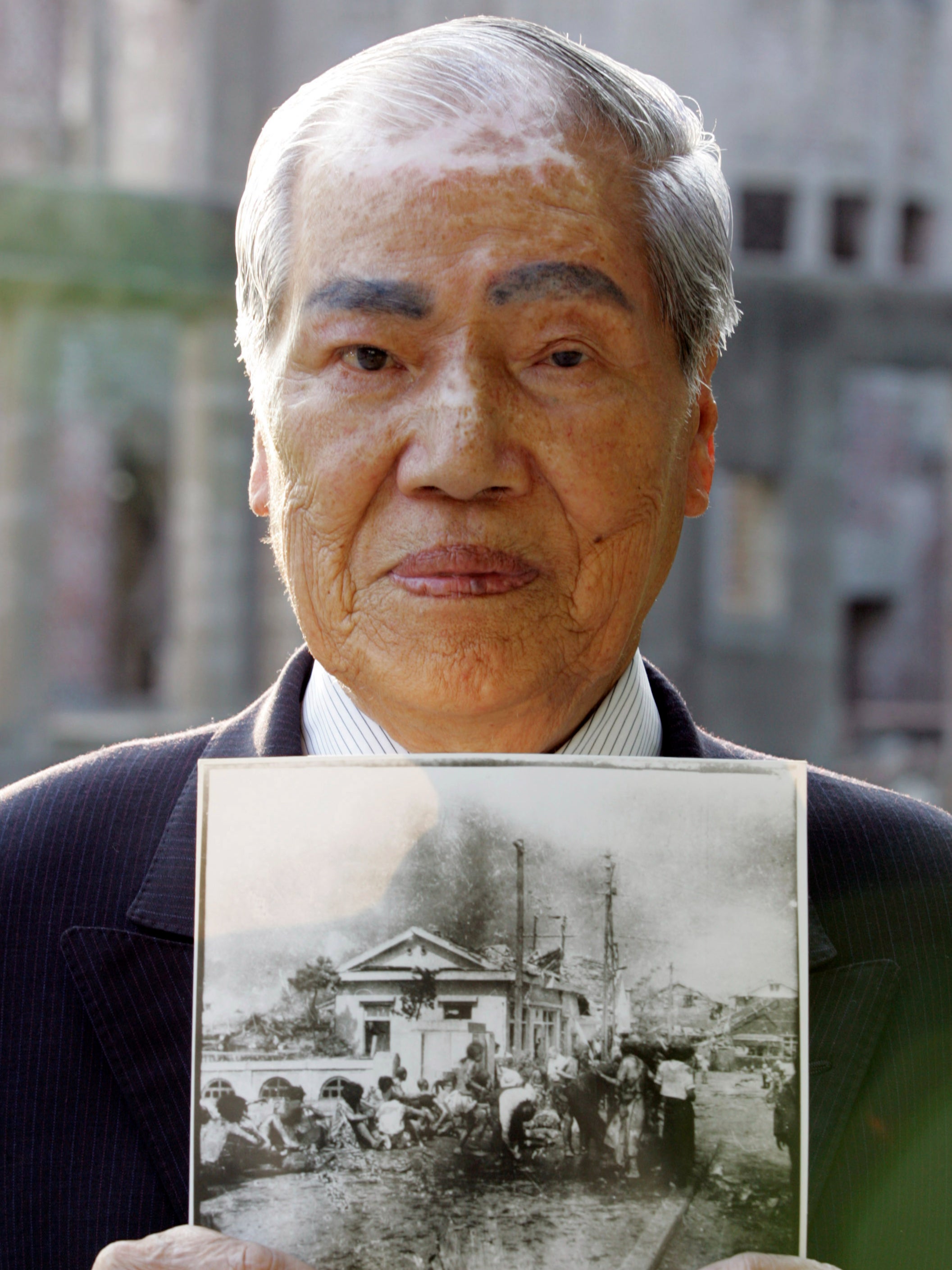 Tsuboi holds a picture taken three hours after the bomb was dropped