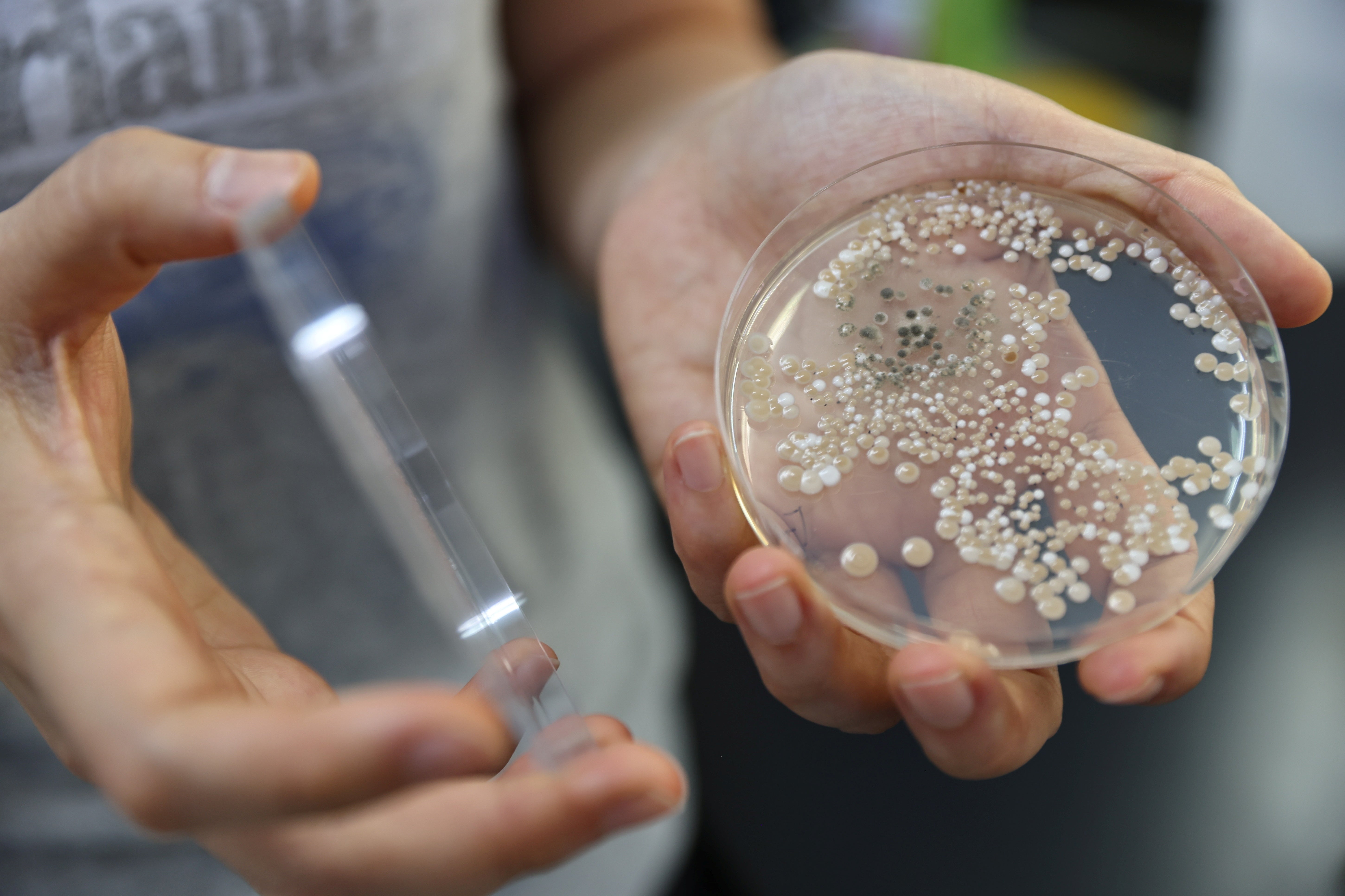 Lin Shiou-ruei holds up a container of microorganism pure culture for research on pest growth