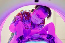 Charity warns of 50,000 ‘missing’ cancer cases with backlog ‘still to hit NHS’